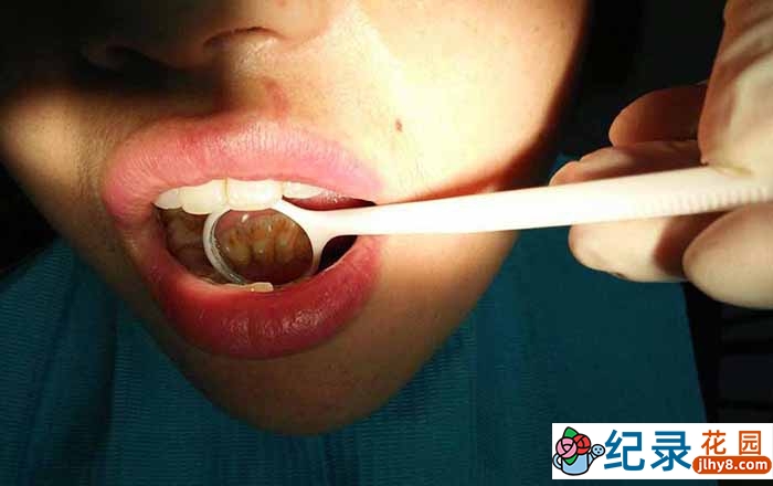 生活解压纪录片《清洗牙结石》全1季原版无字 1080高清纪录片解说素材百度云盘下载插图 生活解压纪录片《清洗牙结石》全1季原版无字 1080高清纪录片解说素材百度云盘下载