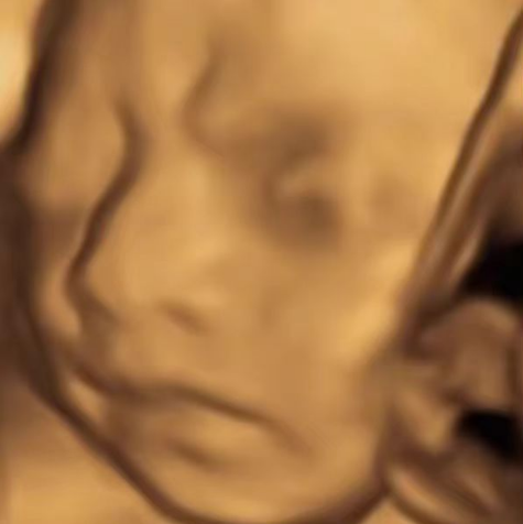 AI四维彩超预测,一单9.9-98,3分钟出图,一天变现1000+插图1 AI四维彩超预测,一单9.9-98,3分钟出图,一天变现1000+