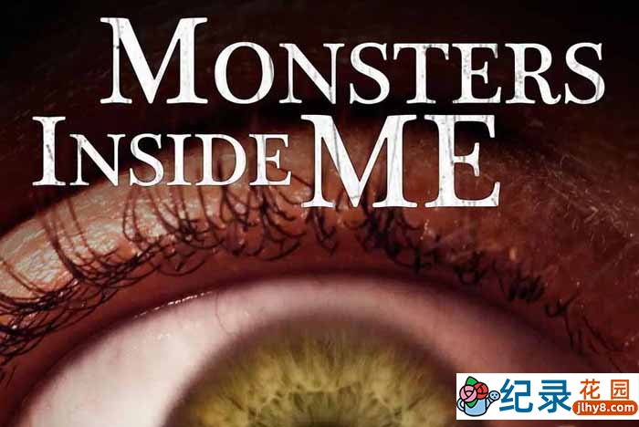 人体微生物研究纪录片《体内的怪物 Monsters Inside Me》第1-4季中字 1080P高清自媒体解说素材百度云盘下载插图 人体微生物研究纪录片《体内的怪物 Monsters Inside Me》第1-4季中字 1080P高清自媒体解说素材百度云盘下载