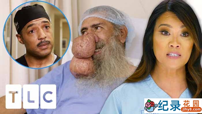 医疗救助纪录片《挤痘大师 Dr. Pimple Popper》第5-6季中字完整含特辑 1080P自媒体解说资源百度云盘下载插图 医疗救助纪录片《挤痘大师 Dr. Pimple Popper》第5-6季中字完整含特辑 1080P自媒体解说资源百度云盘下载