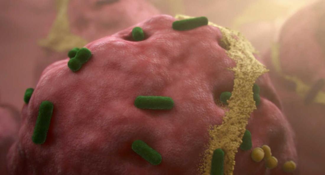 人体上的生命 Life On Us