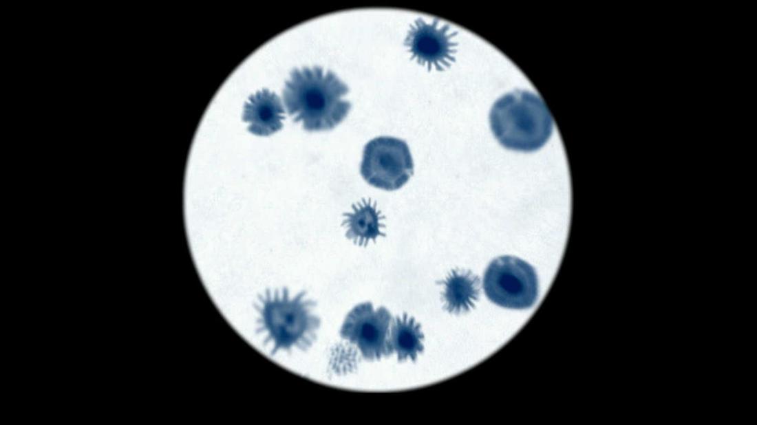 人体上的生命 Life On Us