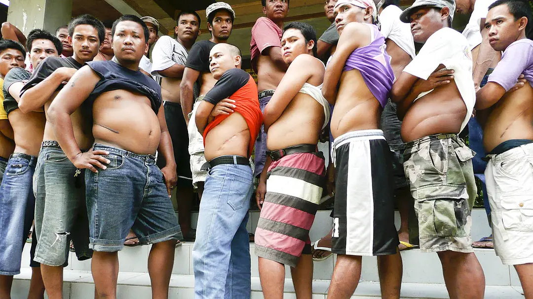 人体器官交易实录 Tales from the Organ Trade