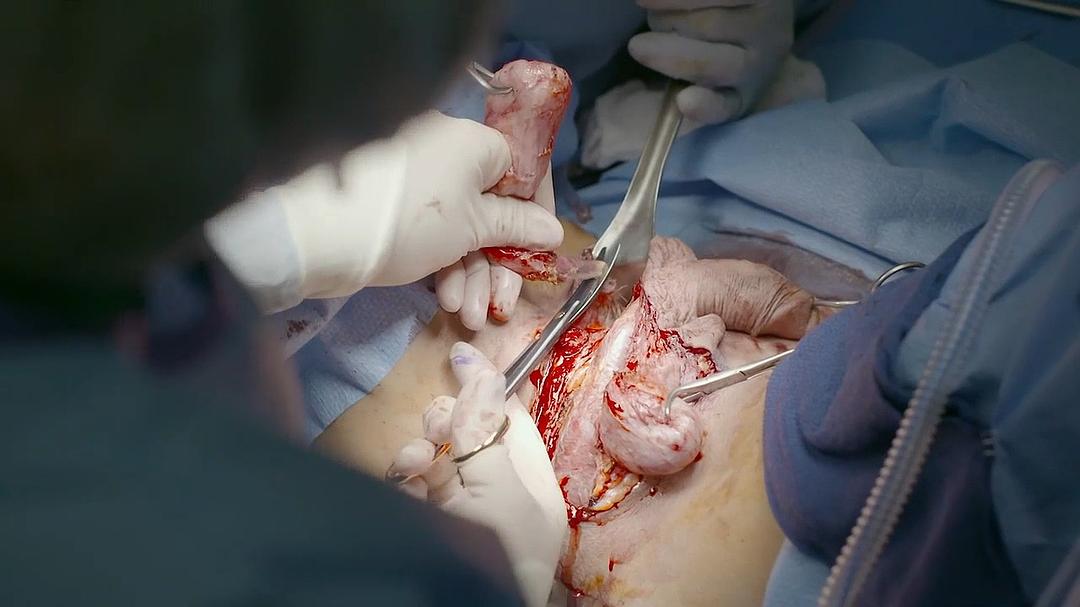 地平线系列:跨性别者 Horizon: Being Transgender