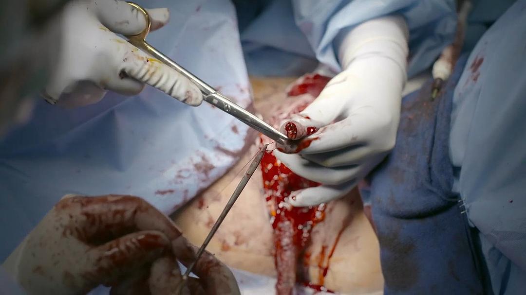 地平线系列:跨性别者 Horizon: Being Transgender