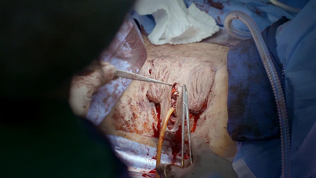 地平线系列:跨性别者 Horizon: Being Transgender