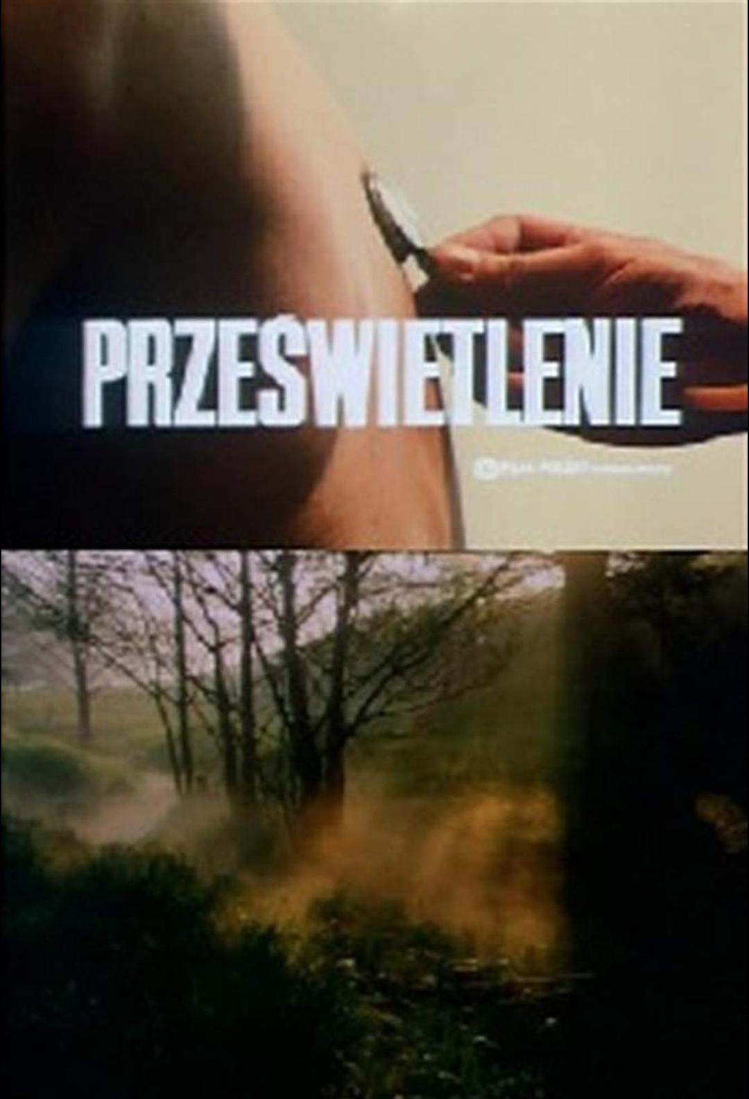 X射线 Prześwietlenie