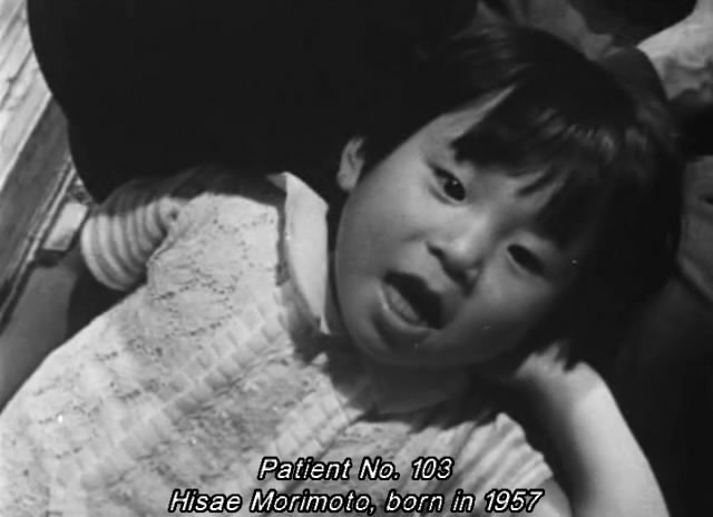 水俣病患者及其世界 水俣 – 患者さんとその世界