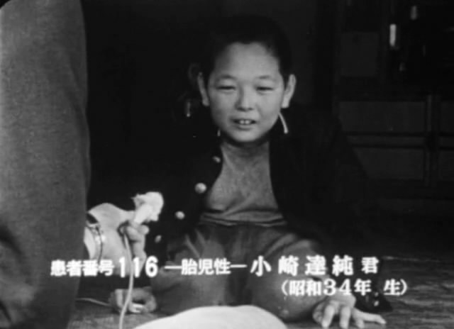 水俣病患者及其世界 水俣 – 患者さんとその世界