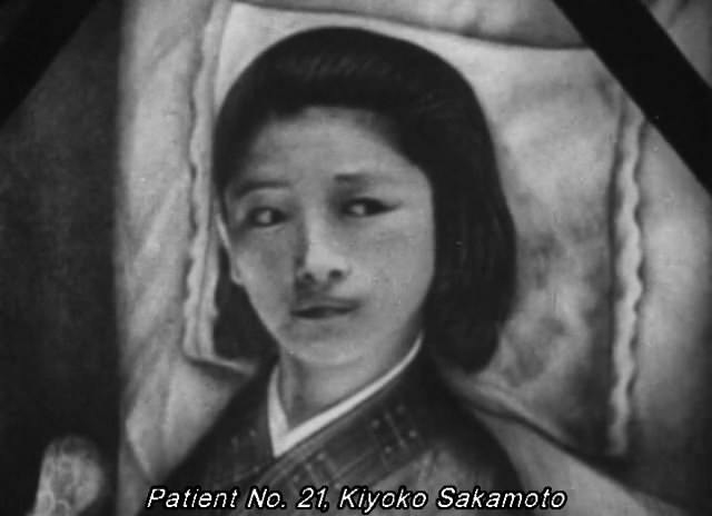 水俣病患者及其世界 水俣 – 患者さんとその世界