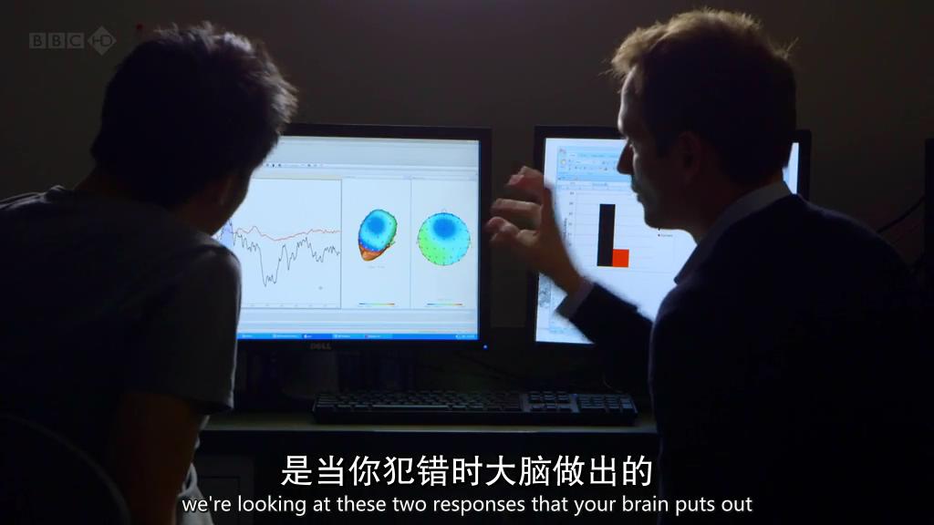 地平线系列:手术不败宝典 Horizon: How to avoid mistakes in surgery
