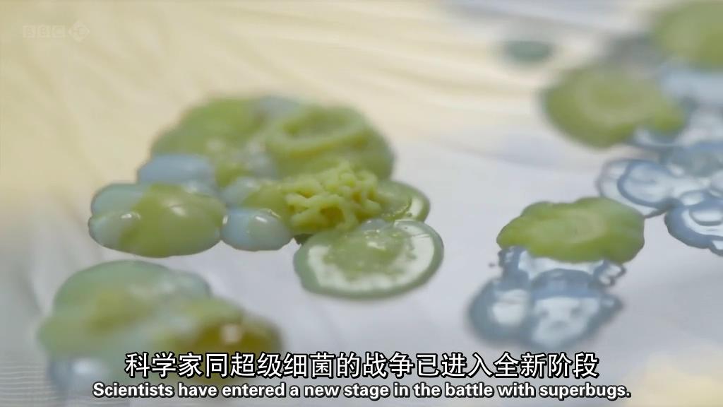 地平线系列:战胜超级病菌 Horizon: Defeating the Superbug