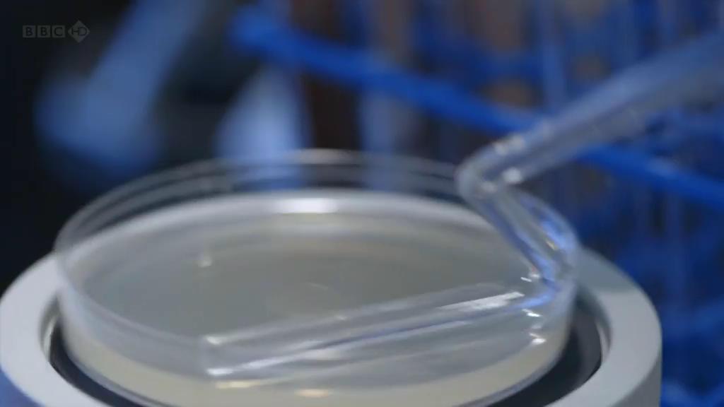 地平线系列:战胜超级病菌 Horizon: Defeating the Superbug