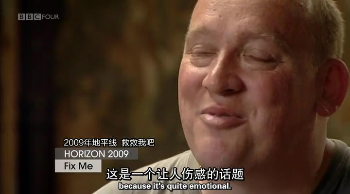 移植指南 Mend Me: A Horizon Guide to Transplants