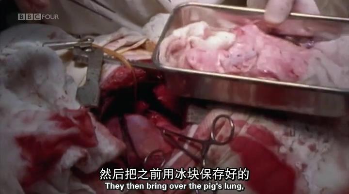 移植指南 Mend Me: A Horizon Guide to Transplants