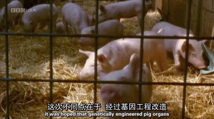 移植指南 Mend Me: A Horizon Guide to Transplants