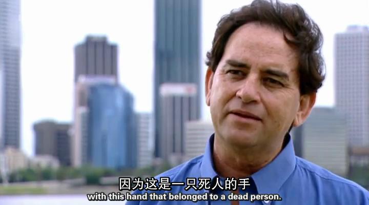 移植指南 Mend Me: A Horizon Guide to Transplants