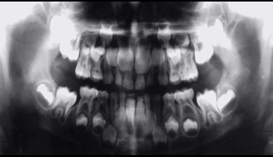 狗心 Heart of a Dog