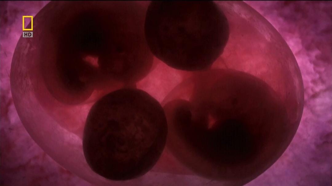 子宫日记:多胞胎 In the Womb: Multiples插图3 子宫日记:多胞胎 In the Womb: Multiples