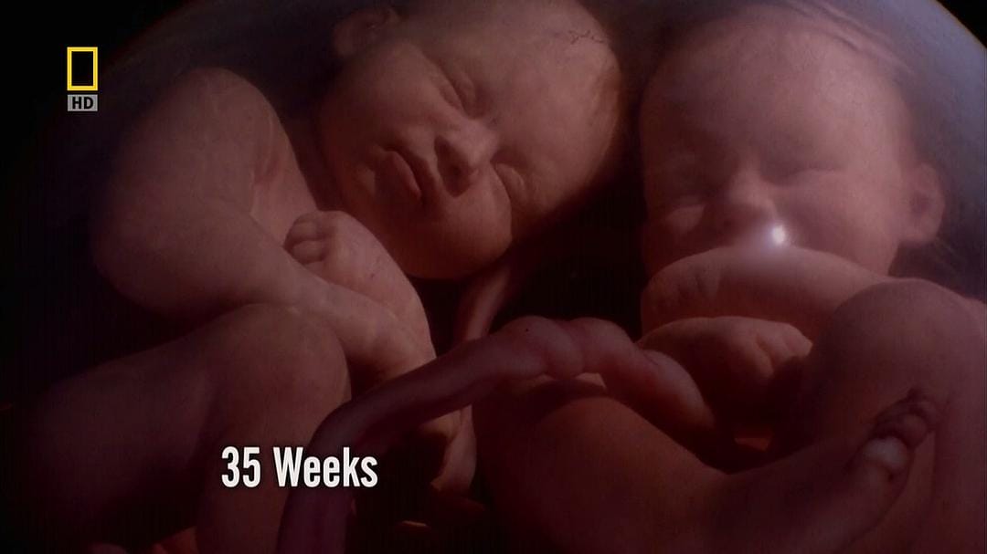 子宫日记:多胞胎 In the Womb: Multiples插图4 子宫日记:多胞胎 In the Womb: Multiples