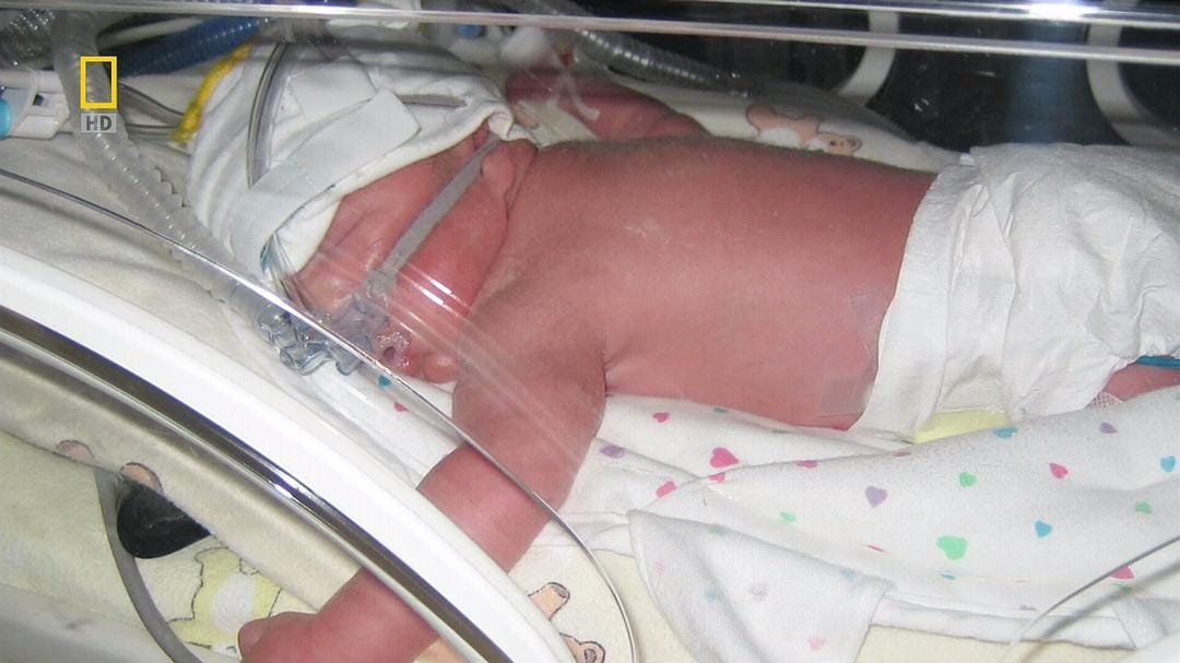 子宫日记:多胞胎 In the Womb: Multiples插图8 子宫日记:多胞胎 In the Womb: Multiples