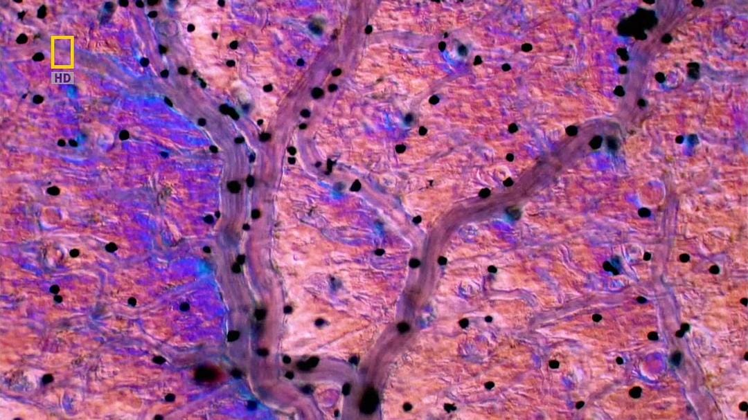 子宫日记:多胞胎 In the Womb: Multiples插图13 子宫日记:多胞胎 In the Womb: Multiples