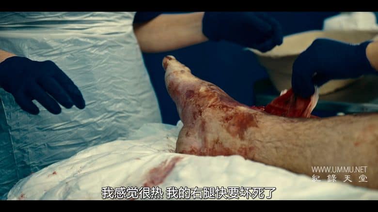 命悬一线:伦敦重症急救实录 Critical: Between Life and Death插图3 命悬一线:伦敦重症急救实录 Critical: Between Life and Death