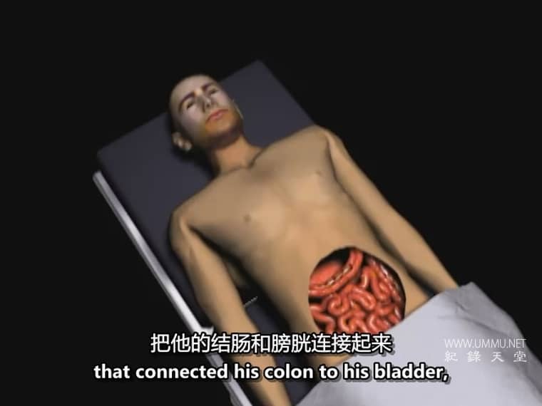 惊人的医学故事 Amazing Medical Stories插图4 惊人的医学故事 Amazing Medical Stories