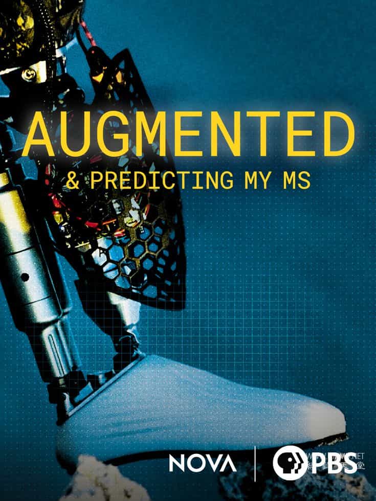 我的多发性硬化症增强与预测 Augmented & Predicting My MS插图 我的多发性硬化症增强与预测 Augmented & Predicting My MS