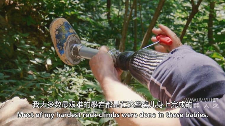 我的多发性硬化症增强与预测 Augmented & Predicting My MS插图2 我的多发性硬化症增强与预测 Augmented & Predicting My MS