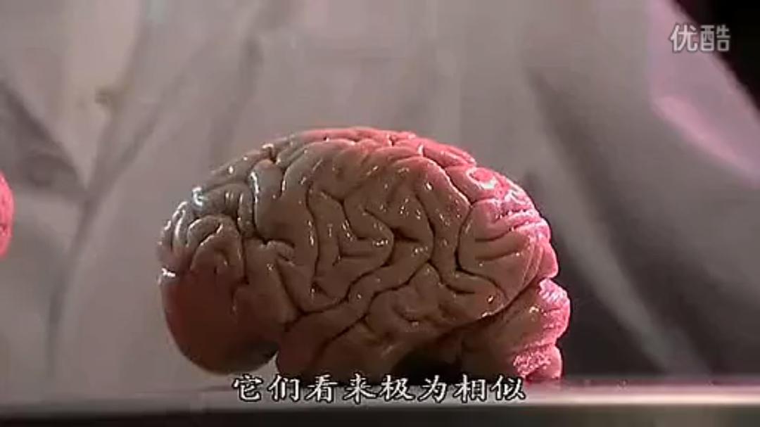 人脑漫游 Brain Story