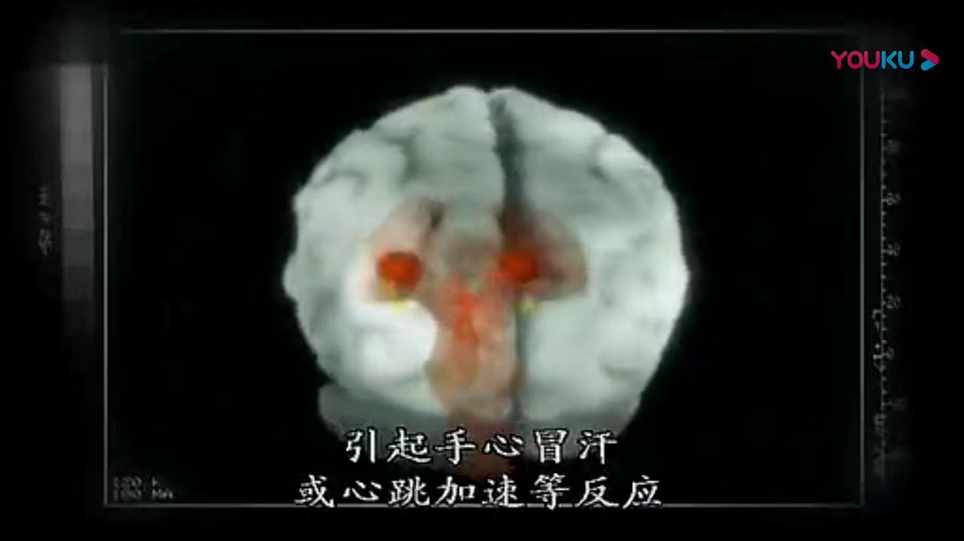 人脑漫游 Brain Story