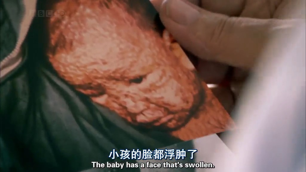 病毒为何致命 Why Do Viruses Kill