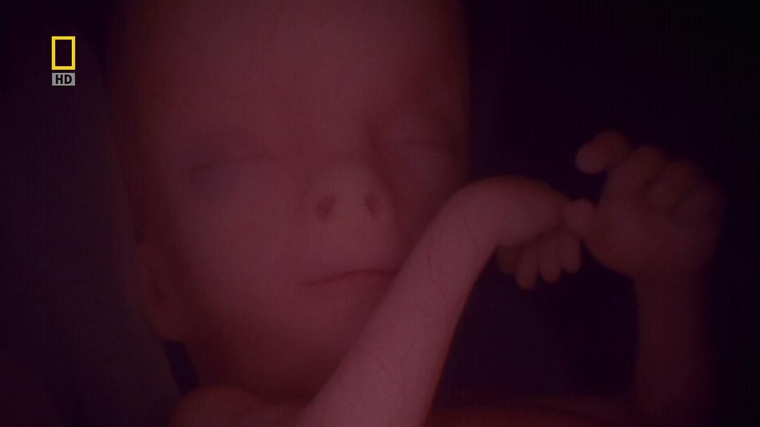 子宫日记：多胞胎 In the Womb: Multiples