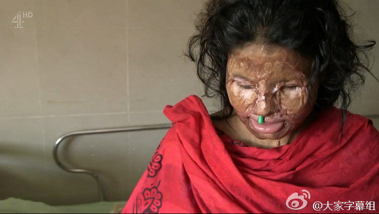 无脸女孩 The Girl Who Lost Her Face