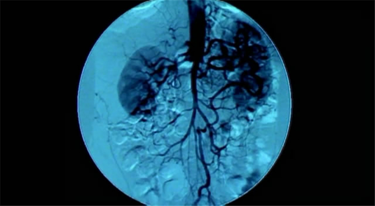 超级新人类 Superhuman