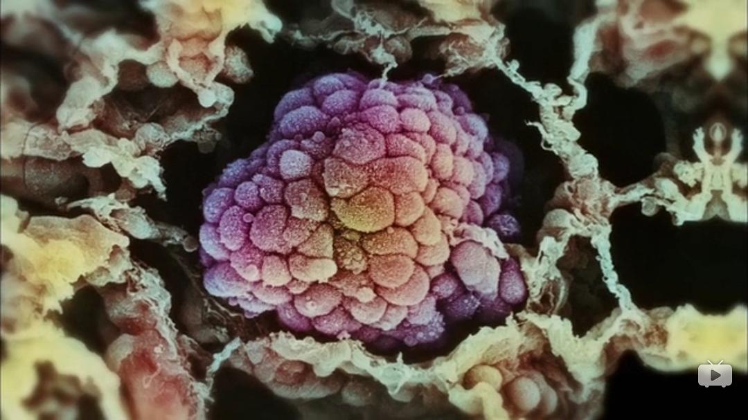 癌症：众疾之皇 Cancer: The Emperor of All Maladies