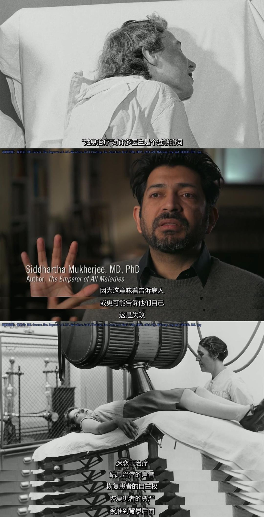 癌症：众疾之皇 Cancer: The Emperor of All Maladies