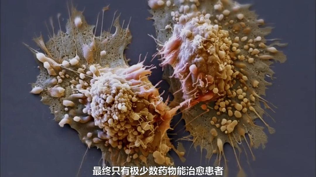 癌症：众疾之皇 Cancer: The Emperor of All Maladies