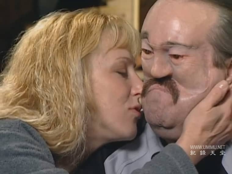 惊人的医学故事 Amazing Medical Stories