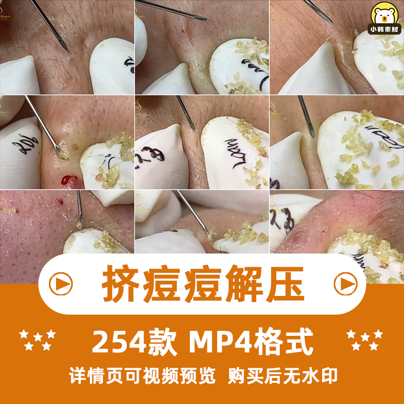 挤痘痘挤去黑头去螨虫国外原声解压减压思维书单高清短视频素材