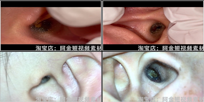 国外助眠直播素材哄睡助眠采耳解压掏耳朵中长高清自媒体视频引流