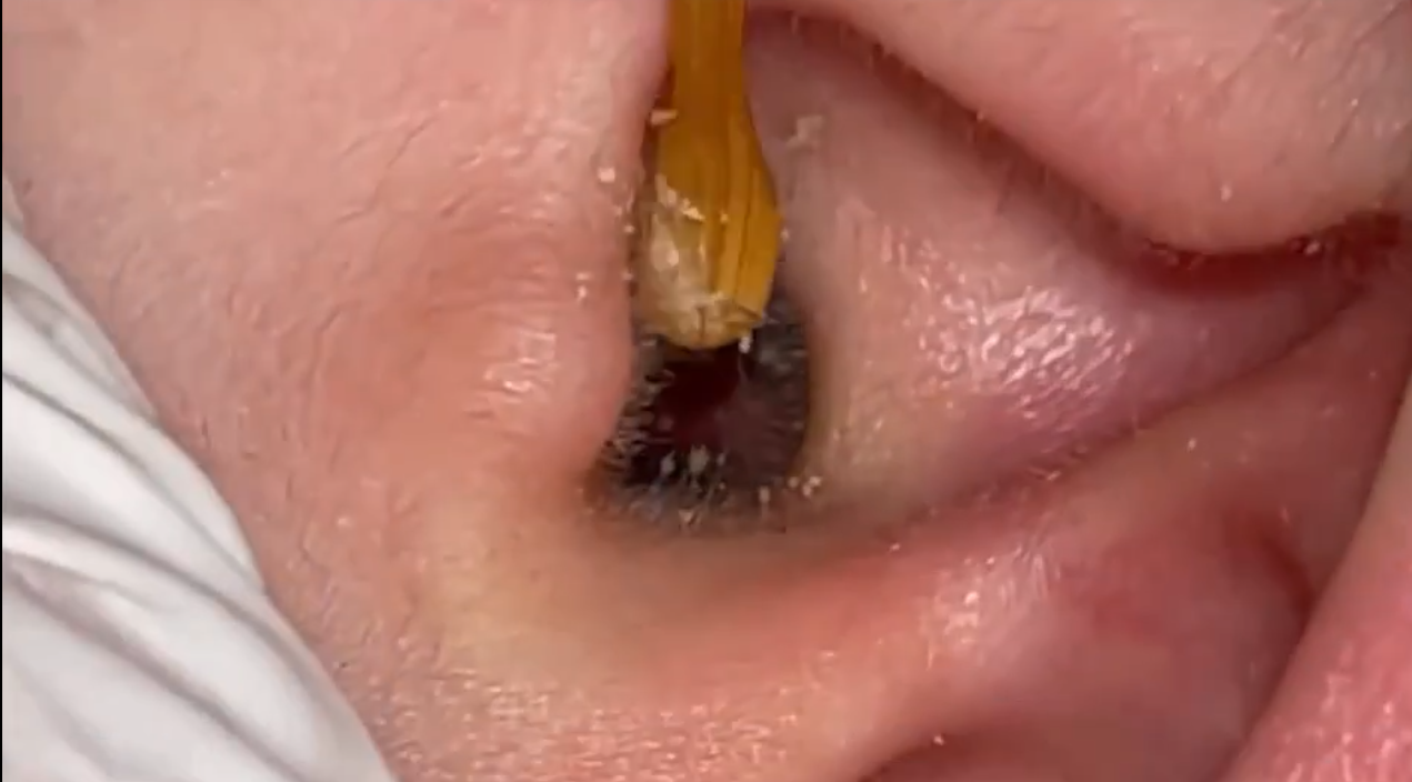 国外助眠直播素材哄睡助眠采耳解压掏耳朵中长高清自媒体视频引流