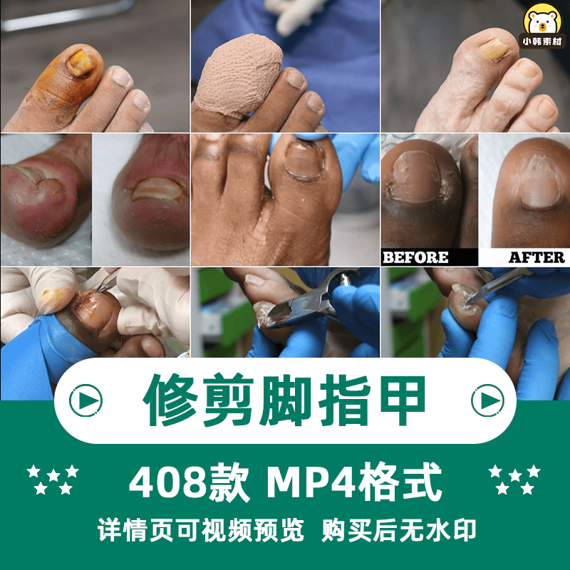 国外高清修脚修死皮剪脚指甲减压视频治愈舒适解压自媒体视频素材