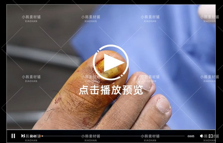 国外高清修脚修死皮剪脚指甲减压视频治愈舒适解压自媒体视频素材