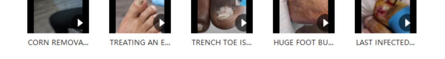 国外高清修脚修死皮剪脚指甲减压视频治愈舒适解压自媒体视频素材