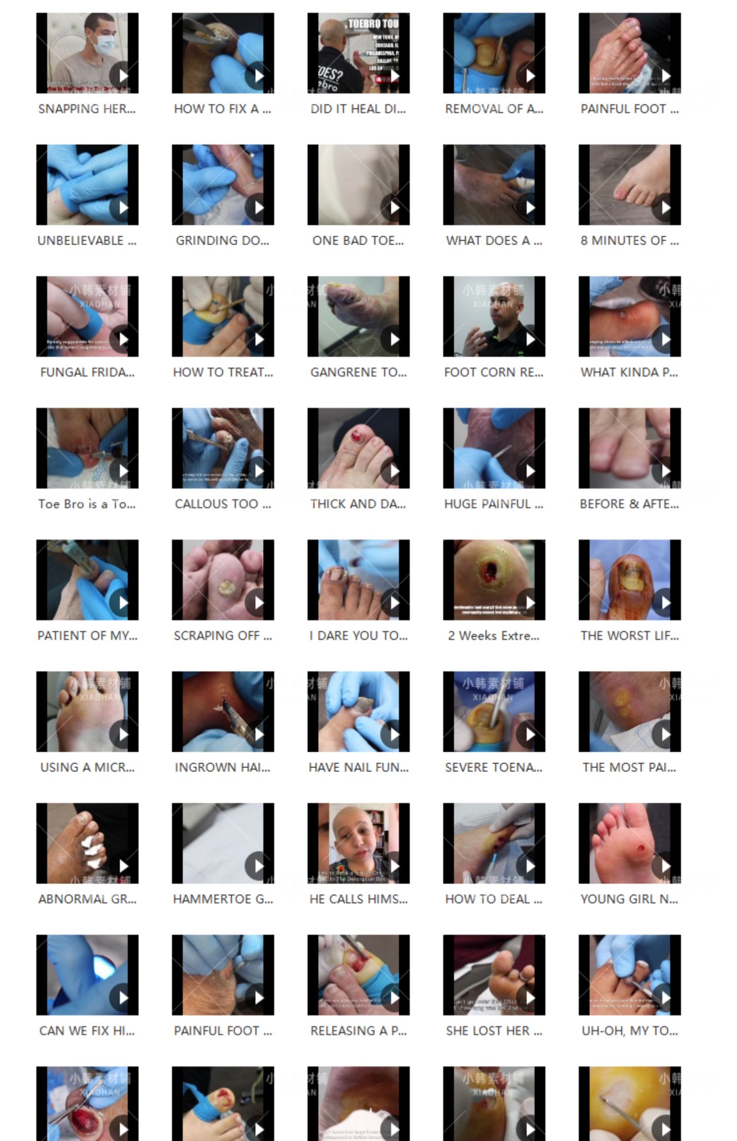 国外高清修脚修死皮剪脚指甲减压视频治愈舒适解压自媒体视频素材