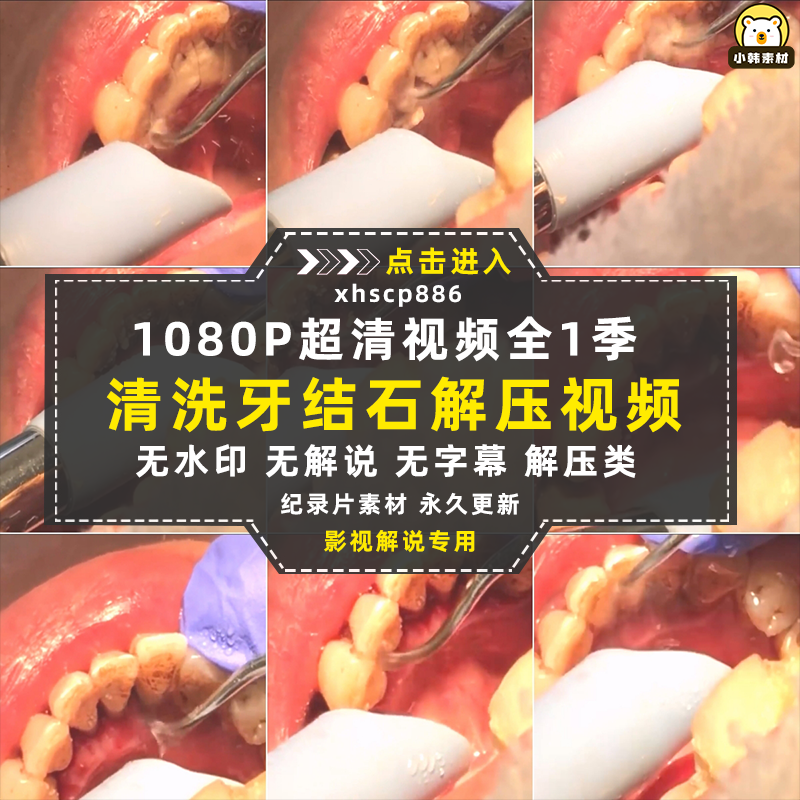 生活解压纪录片清洗牙结石全1季中视频自媒体解说高清视频素材