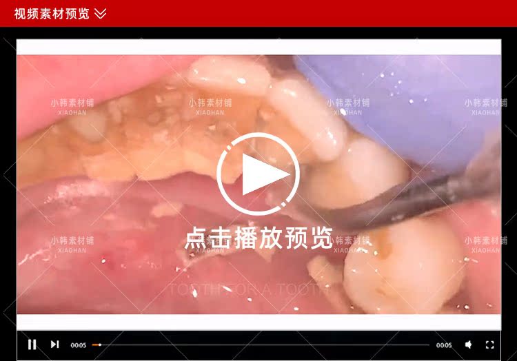 生活解压纪录片清洗牙结石全1季中视频自媒体解说高清视频素材