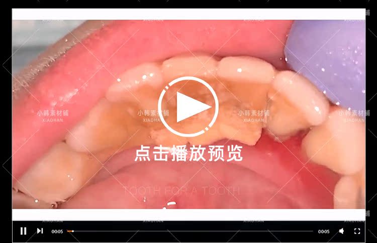 生活解压纪录片清洗牙结石全1季中视频自媒体解说高清视频素材